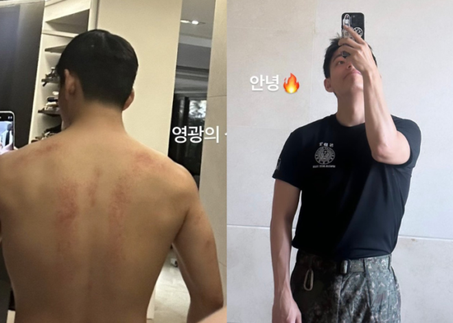 “Luka yang luar biasa,” V BTS (Kim Taehyung) memamerkan bekas luka dan tubuh buncit dari pelatihan militer intensif sebagai prajurit Pasukan Khusus (SDT)