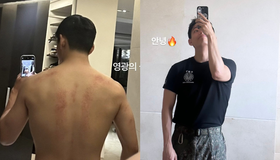 “Luka yang luar biasa,” V BTS (Kim Taehyung) memamerkan bekas luka dan tubuh buncit dari pelatihan militer intensif sebagai prajurit Pasukan Khusus (SDT)